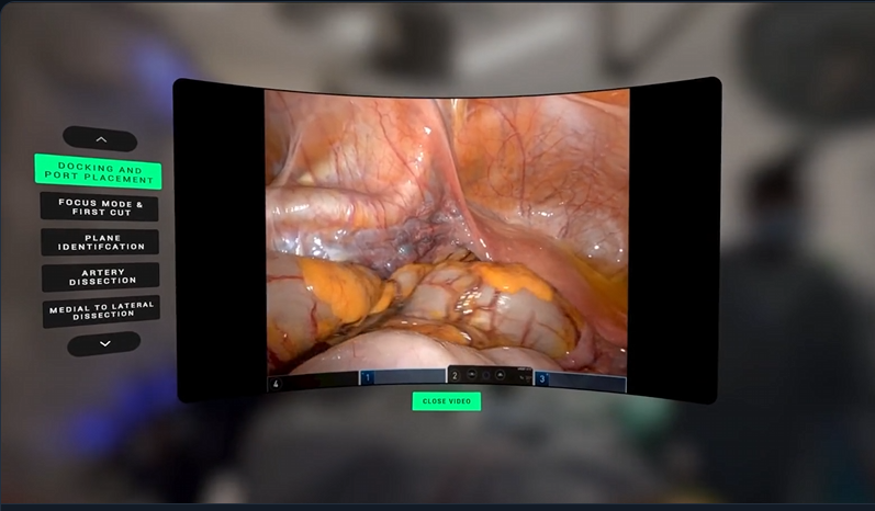 Stereoscopic robotic surgery footage playing on the curved in-headset screen, with the chapter list alongside and the operating theatre behind